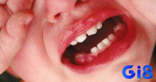 Mơ thấy mất nhiều chiếc răng có thể phản ánh những khó khăn và thử thách mà bạn cần vượt qua