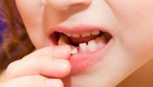 Giải mã giấc mơ thấy rụng răng chảy máu: Điềm lành hay dữ?