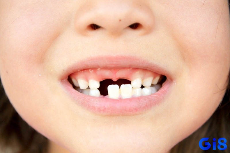 Khi giải mã giấc mơ bị rụng răng, cần xem xét nhiều yếu tố tâm lý liên quan đến áp lực và lo âu trong cuộc sống