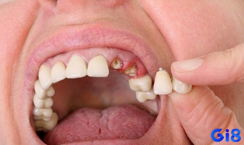 Giải thoát cảm xúc tiêu cực sau giấc mơ rụng răng